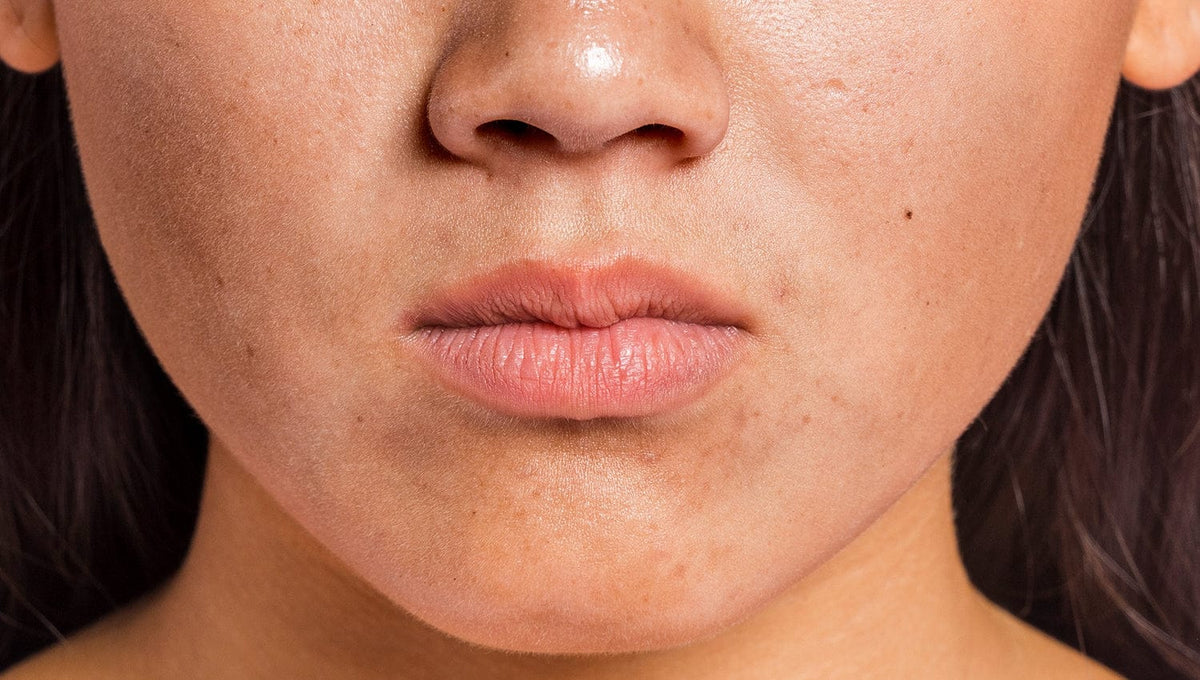 How Air-Conditioning Is Silently Destroying Your Skin Barrier in Singapore