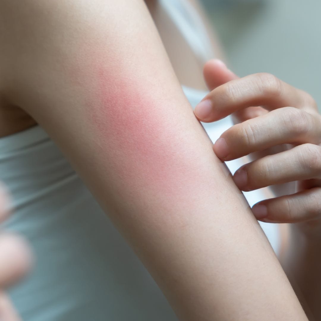 What Is the Skin Microbiome - And Why Is Yours Out of Balance?