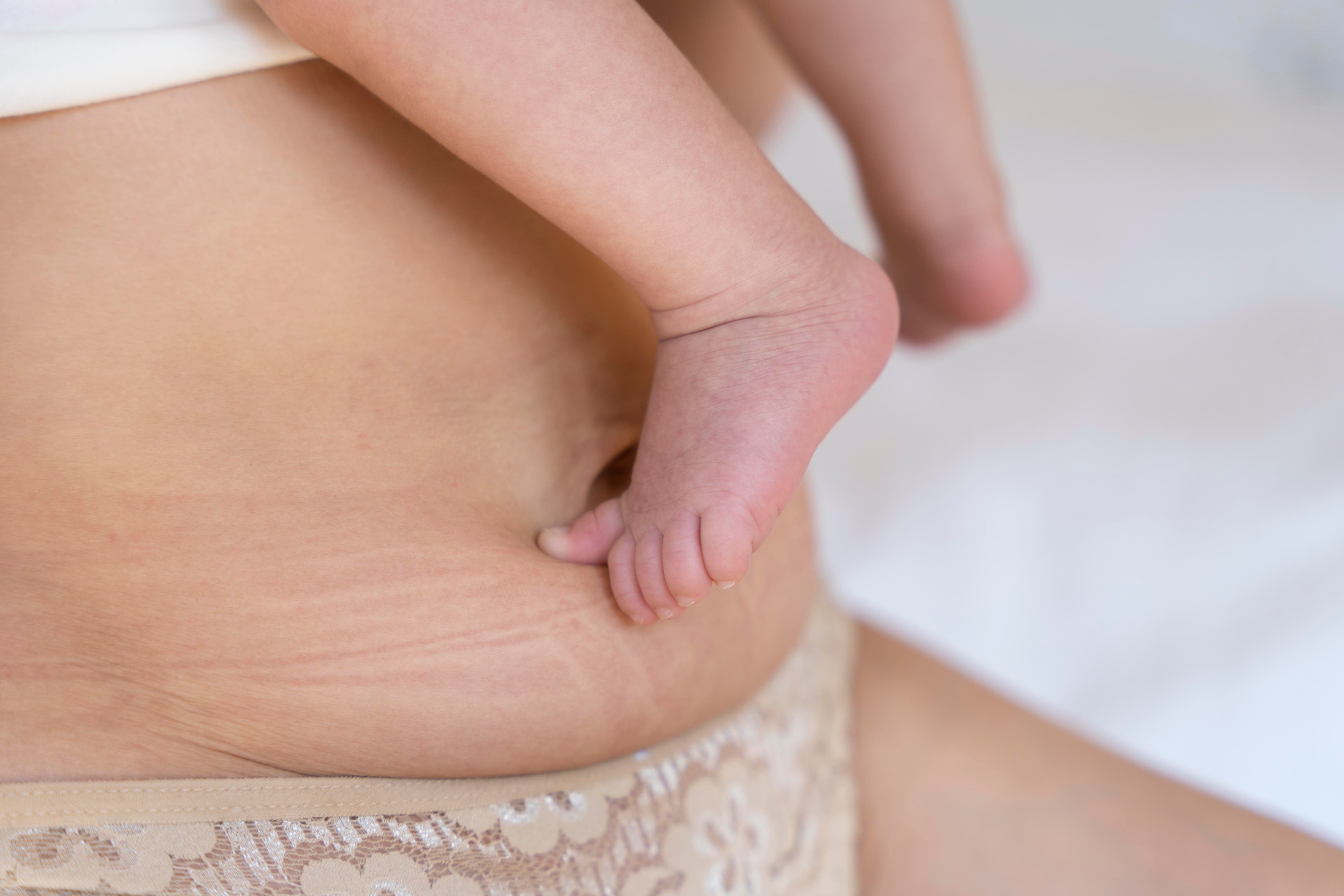 Postpartum Recovery