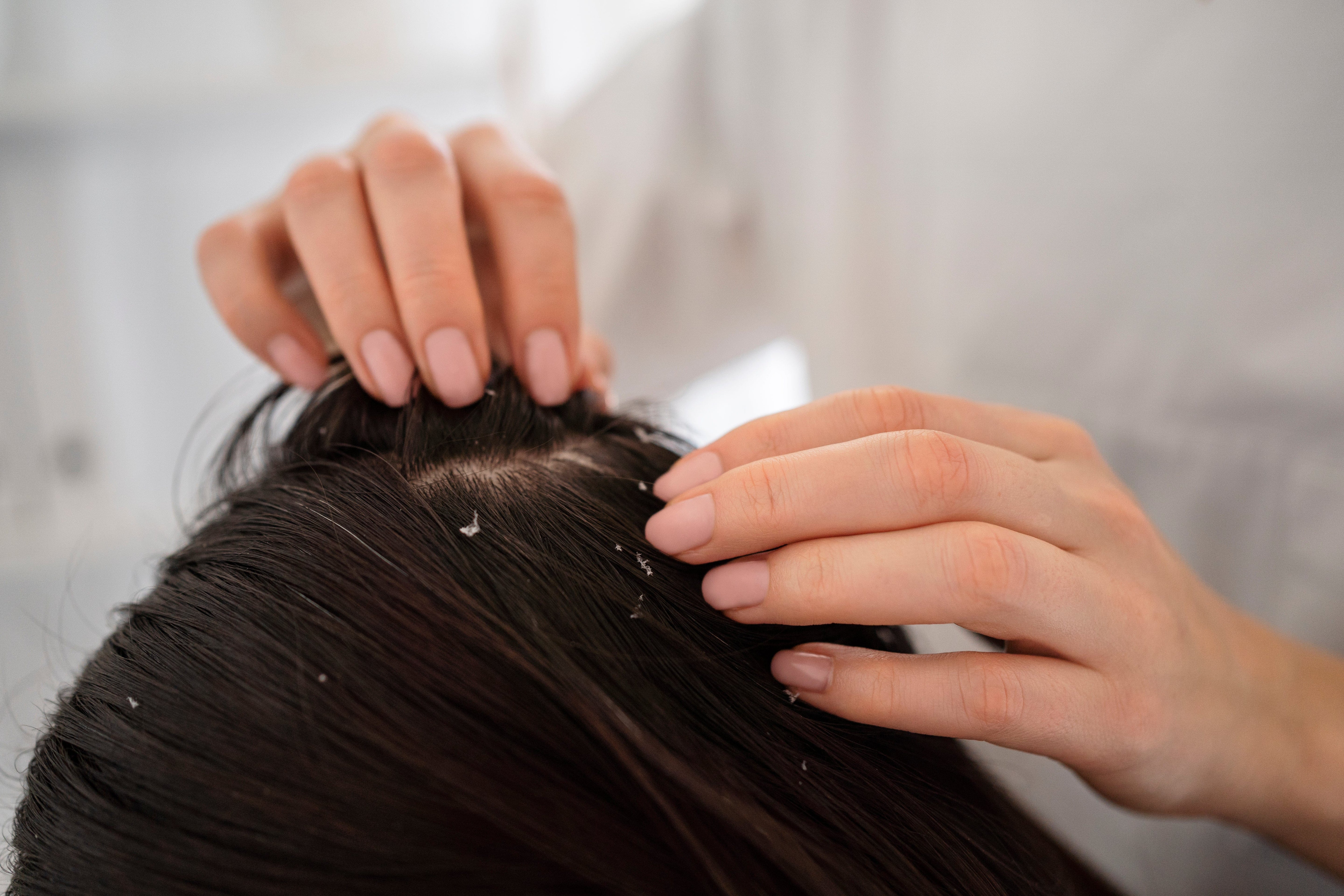 Hair & Scalp Health (Revamp)