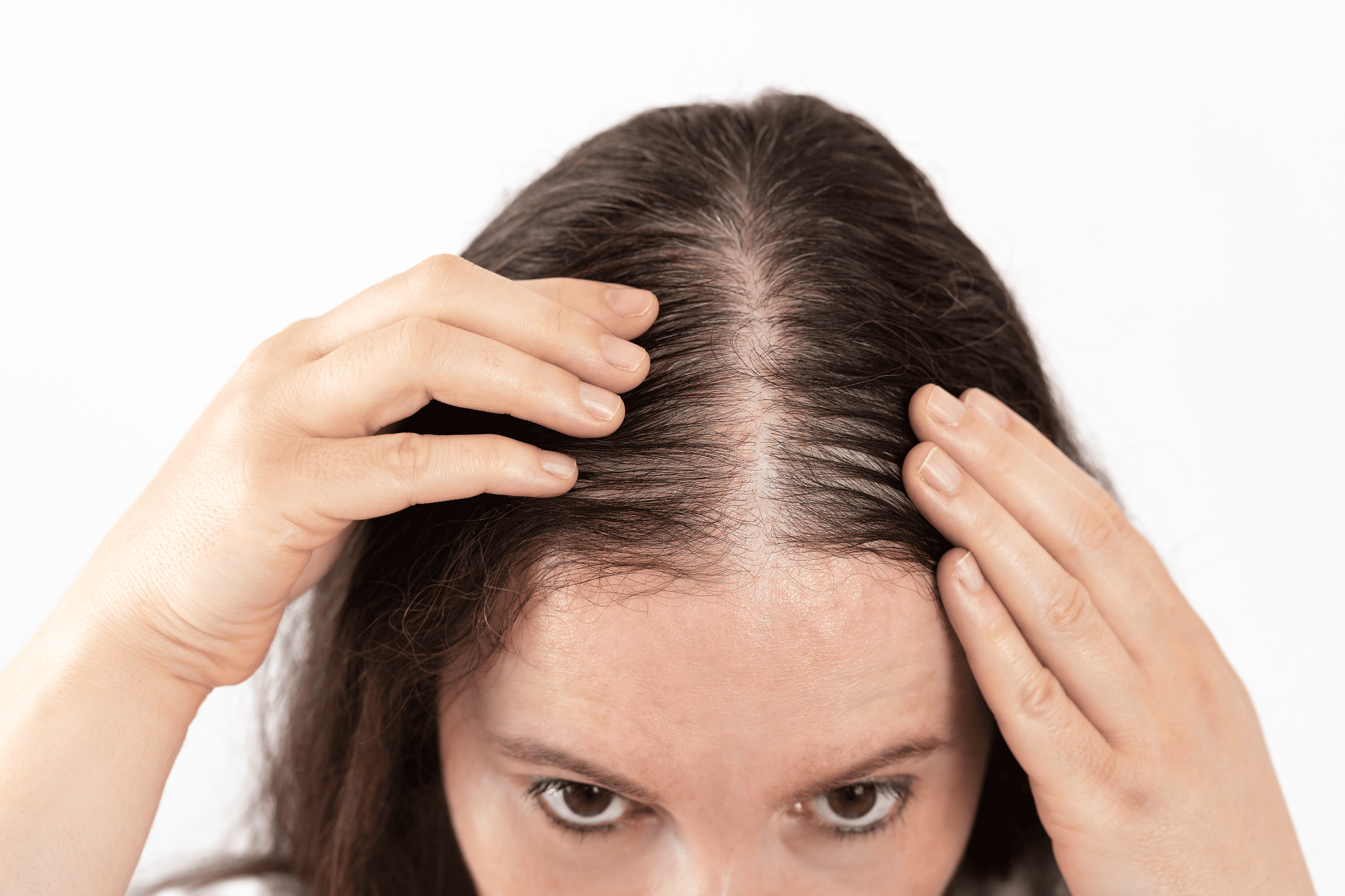 Home Remedies for Thinning Hair 